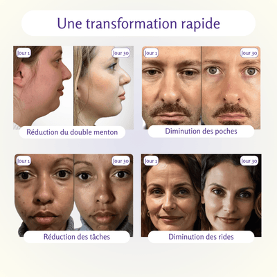 SkinGlow™- Brillez, Sculptez, Rajeunissez + 1 sérum offert