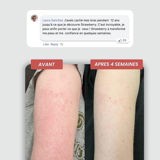 Arrêtez de Cacher Vos Bras.  Commencez à Vivre Sans Calculs.