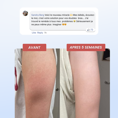 Arrêtez de Cacher Vos Bras.  Commencez à Vivre Sans Calculs.